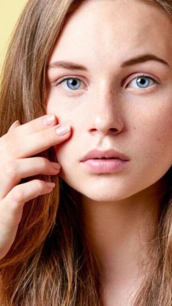 How to pop a pimple without the fear of scarring?
