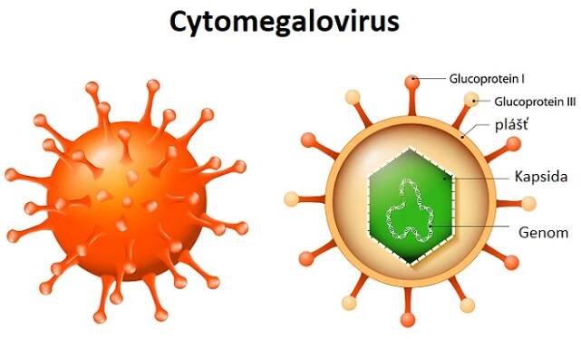 Cytomegalovirus (CMV) - příznaky, příčiny a léčba