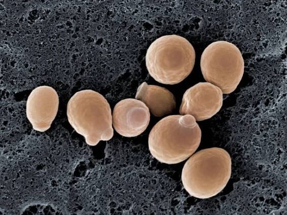 kvasinkové buňky (candida albicans), sem - vulvo vaginitis - stock snímky, obrázky a fotky