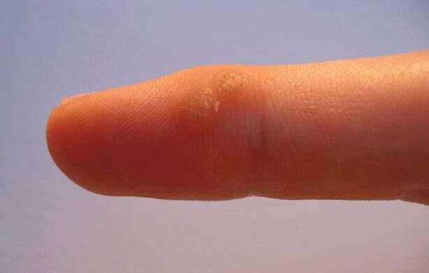 foto. wikipedia.org