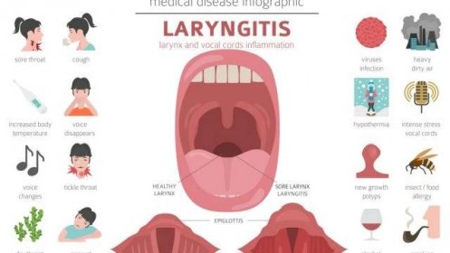 Akutní laryngitida a pseudokrup – jaké jsou projevy?