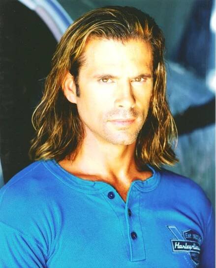 Facelift Case Studies – Lorenzo Lamas Facelift – Before & After