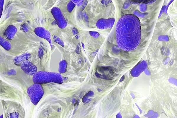 Why UV Light Disinfection?
