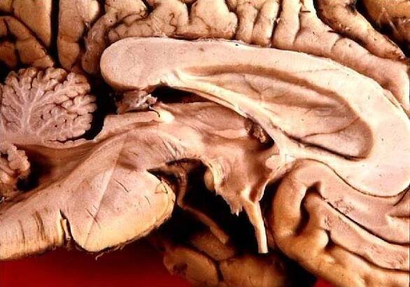 Thalamus – Wikipedie