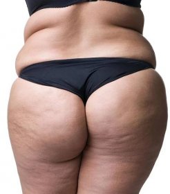 Tlusté ženské tělo s celulitida, tukové boky a hýždě
