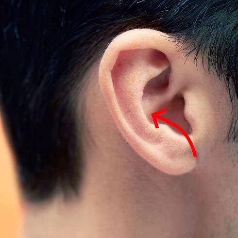 What Is a 'Conch Removal' Procedure, and Why Did This Man Do It to His Ears?