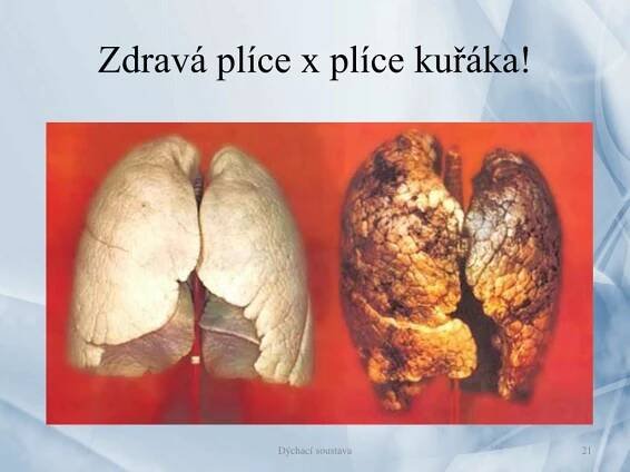 PPT - Dýchací soustava PowerPoint Presentation, free download - ID:4599394