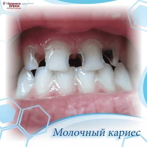 Стоматология в Калуге «Здоровые зубки для всей семьи» - выгодные цены от 150 руб.