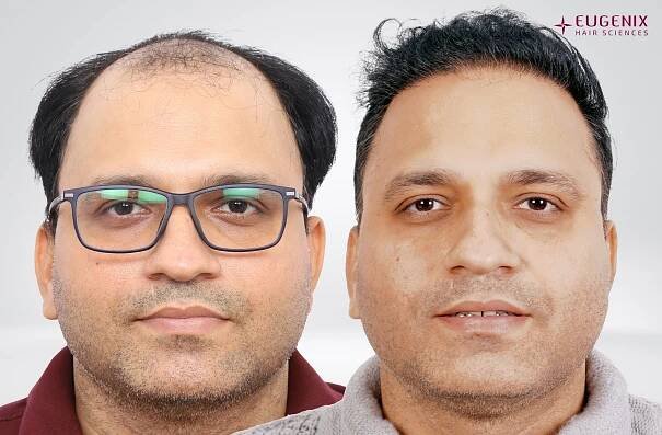 SUSHIL KUMAR PANDEY Front Before and After