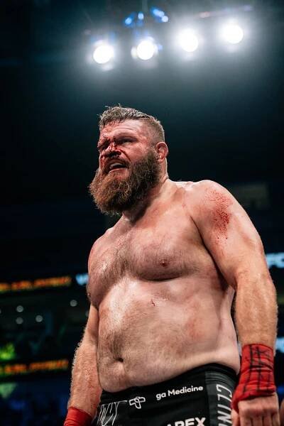 Former UFC Champ Andrei Arlovski Earns Doctor's Stoppage TKO Against Josh Copeland - BKFC 76 Highlights