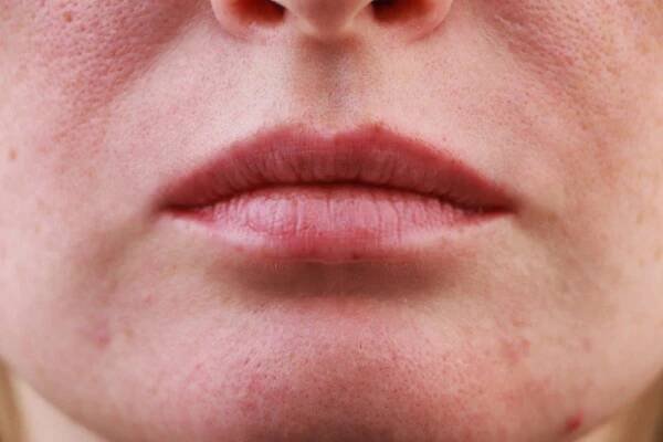 Dry Skin With Clogged Pores – 05 Skin Care Steps