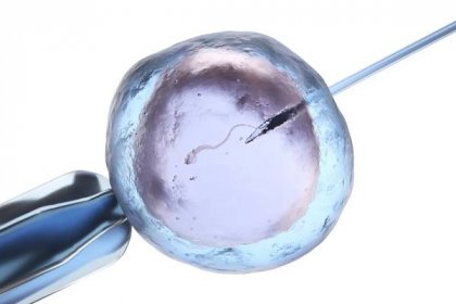 umělé oplodnění nebo oplodnění in vitro - inseminace - stock snímky, obrázky a fotky