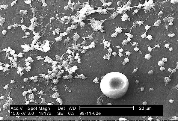 čísla, staphylococcus aureus, bakterie, fond, luminálním, povrch, přebývající, katetr