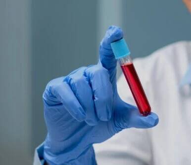 Laborantka v ochranných rukavicích drží zkumavku s odebraným vzorkem krve, laboratorní prostředí v pozadí.