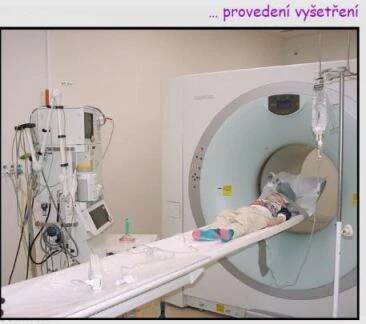Specifika PET a PET/CT vyšetření u dětských pacientů na oddělení nukleární medicíny. » Linkos.cz