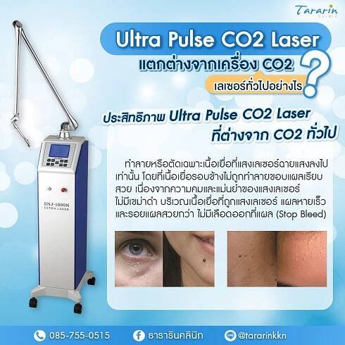 CO2 Laser Ultra Pulse