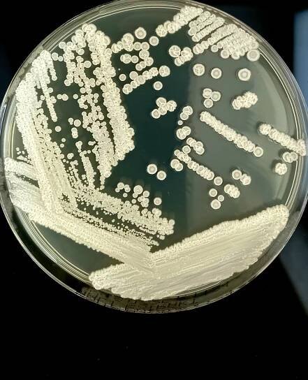 Obrázek - Candida parapsilosis | BioLib.cz
