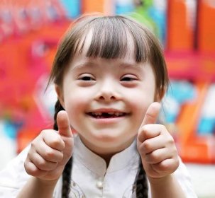 portrét dívky s down syndromem - child thumbs up - stock snímky, obrázky a fotky