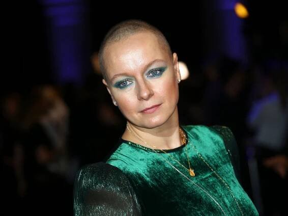 Samantha Morton Has Seen and Survived Hollywood’s Dark Side