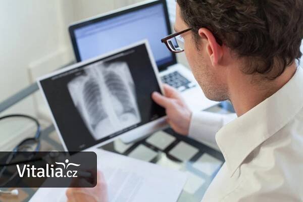 Potíže s dechem, suchý kašel a únava mohou být příznakem plicní hypertenze - Vitalia.cz
