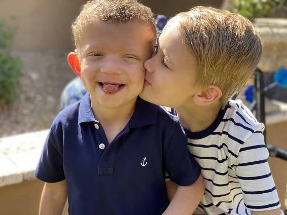 Mission and Vision — Cardio Facio Cutaneous syndrome International