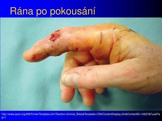 PPT - Infekce ran, hnisavé a anaerobní infekce PowerPoint Presentation - ID:6935596