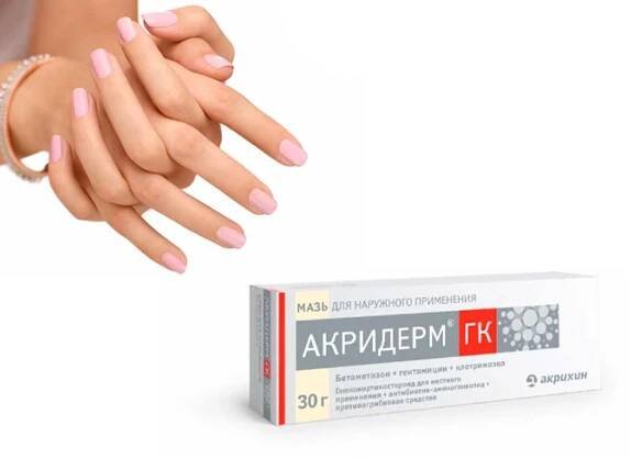 Акридерм при грибке кожи
