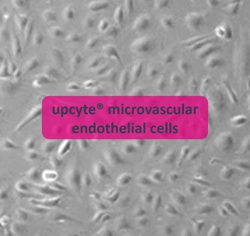 Upcyte