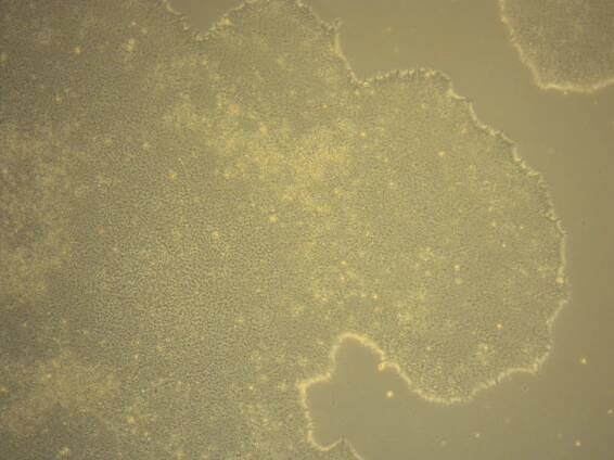 BIONi010-C-6 · Cell Line · EBiSC