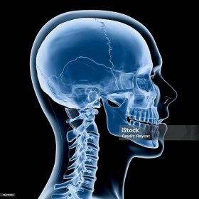 Rentgen hlavy a krku - Bez autorských poplatků Lebka člověka Stock fotka