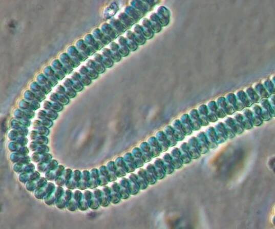 Cyanobacteria under microscope 2