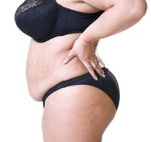 Bolest zad, tlustá žena s bolestmi zad, s nadváhou ženské tělo izolovaných na bílém pozadí s červenými skvrnami, boční pohled — Stock obrázek