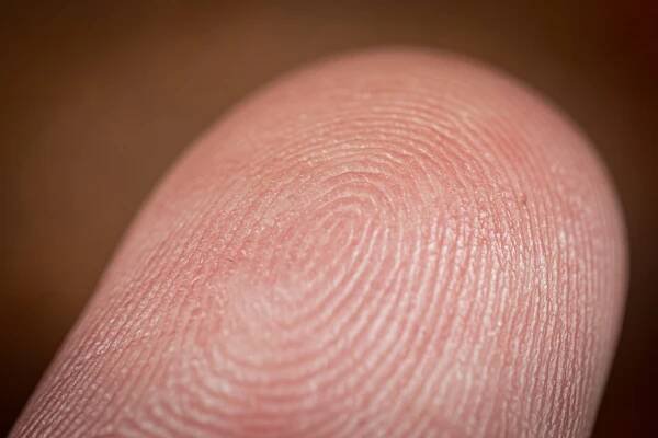 Photo of a finger.
