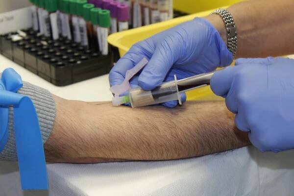 Musí zvýšená hladina CRP znamenat léčbu antibiotiky? Rozhodně ne!