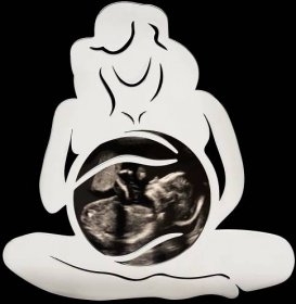 Baby Bump Ultrasound Photo Frame