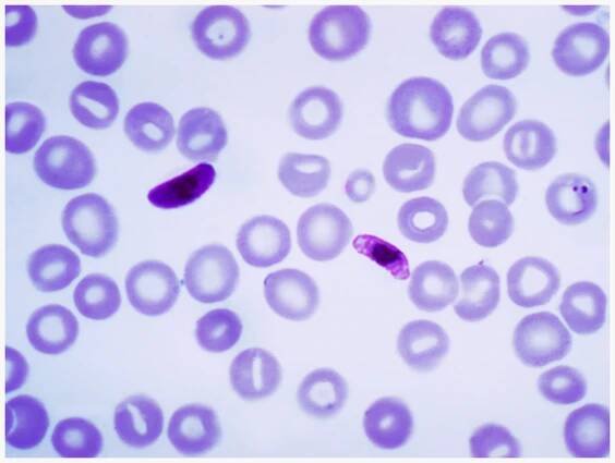 Nejnebezpečnějším původcem malárie je prvok zimnička tropická  (Plasmodium falciparum),  který se vyskytuje v tropech Afriky,  Asie i Ameriky | foto:  CDC/PHIL,  licence Public Domain,  volné dílo