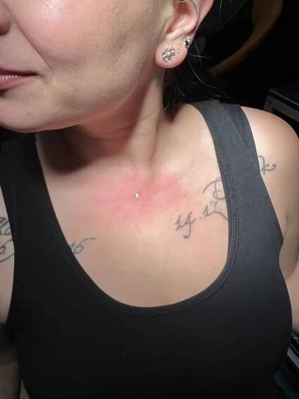 Microdermal - Haluznice - Tetování a piercing