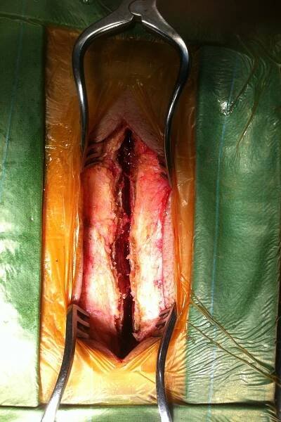 Inter-operation3
