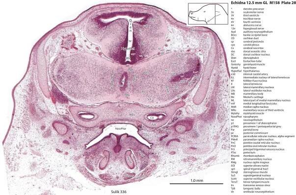 Echidna 12.5 mm GL (prehatching) — Comparative Brain Anatomy