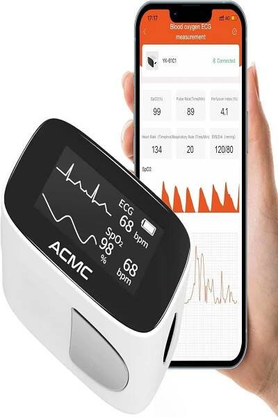 Portable EKG Monitor: 8 Life-Saving Uses