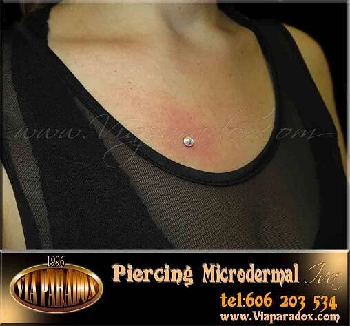 Microdermal - Via Paradox