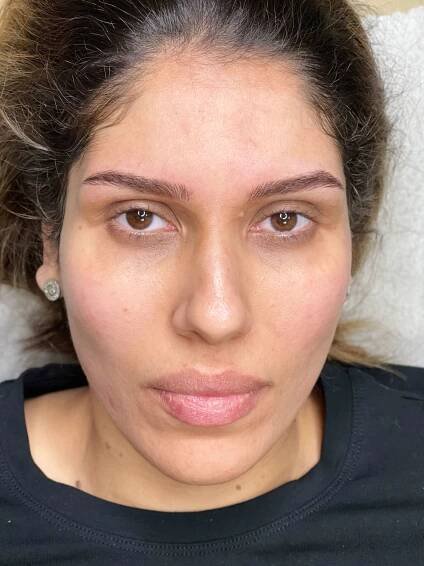 Microblading-
