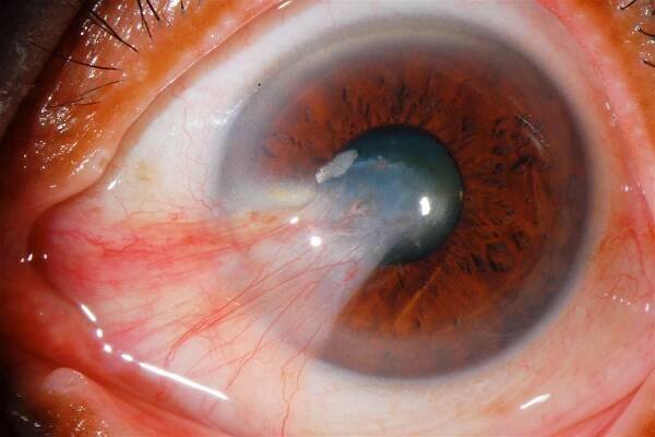 Case 2: Diagnosis & Conclusions
