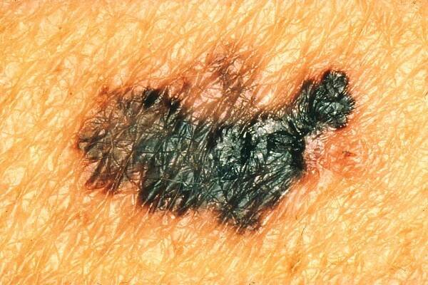 Dermatologie – Wikipedie