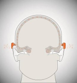 Oticon Medical Ponto bone-anchored hearing system
