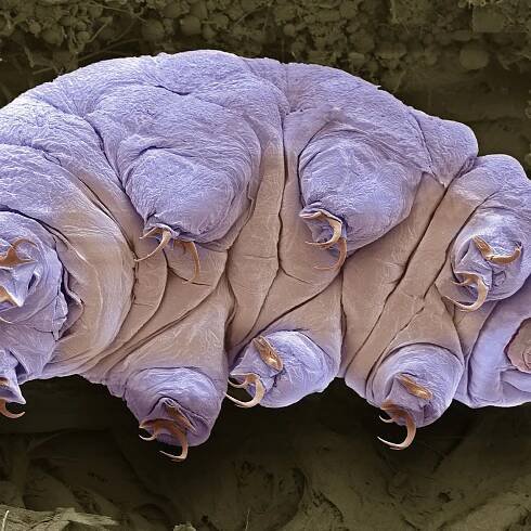 How Are Tardigrades So 'Indestructible?' Scientists Finally Have an Explanation