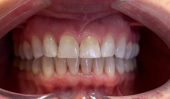DENTÁLNÍ HYGIENA | Ortodoncie MUDr. Hana Benešová 