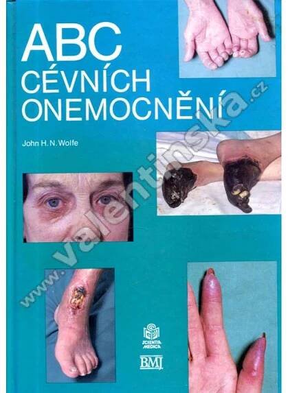 ABC cévních onemocnění