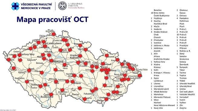 Prevence hydroxychlorochinové a chlorochinové retinopatie | Česká revmatologická společnost ČLS JEP