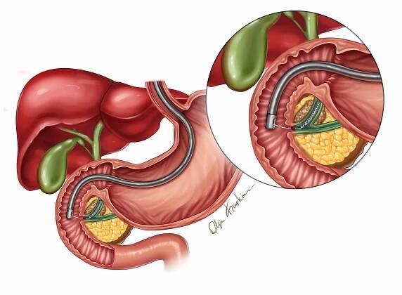 Professional freelance medical illustrator